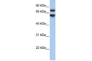 Junctophilin 3 antibody used at 1 ug/ml to detect target protein. (Junctophilin 3 抗体  (N-Term))