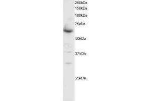 Image no. 1 for anti-SMAD Family Member 4 (SMAD4) (C-Term) antibody (ABIN374104) (SMAD4 抗体  (C-Term))