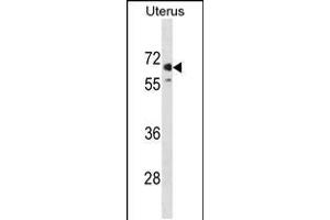 Western blot analysis in human Uterus tissue lysates (35ug/lane). (MMEL1 抗体  (N-Term))