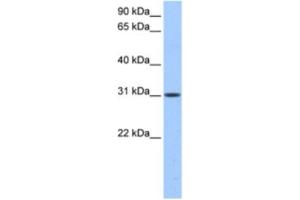 Western Blotting (WB) image for anti-HUS1 Checkpoint Homolog B (HUS1B) antibody (ABIN2463539) (HUS1B 抗体)