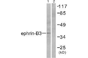 Western blot analysis of extracts from SKOV3 cells, using Ephrin-B3 antibody (#C0182). (Ephrin B3 抗体)