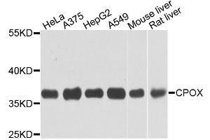 Western blot analysis of extracts of various cell lines, using CPOX antibody. (CPOX 抗体)