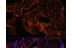 Immunofluorescence analysis of Human placenta using Factor IX / F9 Polyclonal Antibody at dilution of 1:100 (40x lens). (Coagulation Factor IX 抗体)