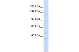 Western Blotting (WB) image for anti-Sterol Regulatory Element Binding Transcription Factor 2 (SREBF2) antibody (ABIN2463718) (SREBF2 抗体)