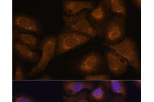 Immunofluorescence analysis of U-2 OS cells using STAR Polyclonal Antibody at dilution of 1:100 (40x lens). (STAR 抗体)