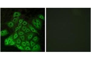 Immunofluorescence analysis of A549 cells, using CSRL1 Antibody. (CSRL1 (AA 400-449) 抗体)