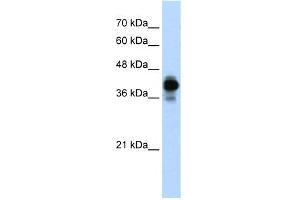 WB Suggested Anti-HNRPC Antibody Titration:  0. (HNRNPC 抗体  (N-Term))