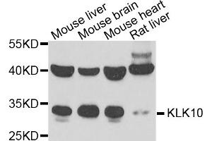 Western blot analysis of extracts of various cell lines, using KLK10 antibody. (Kallikrein 10 抗体)