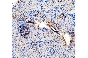 IHC analysis of CD31/Pecam1 using anti-CD31/Pecam1 antibody (ABIN7601662). (CD31 抗体  (AA 41-258))