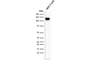 Western Blot Analysis of MCF-7 cell lysate using E-Cadherin Mouse Monoclonal Antibody (4A2).