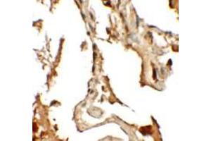 Immunohistochemistry of RLP2 in human lung tissue with RLP2 antibody at 2. (RILPL2 抗体  (Middle Region))