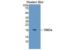 Western blot analysis of the recombinant protein. (LAMB2 抗体  (AA 1178-1311))