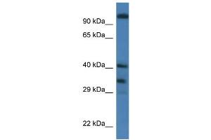 WB Suggested Anti-Morf4l1 Antibody   Titration: 1. (MORF4L1 抗体  (Middle Region))