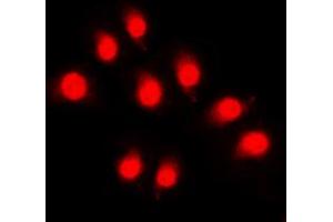 Immunofluorescent analysis of Rpb1 CTD (pSer5) staining in HeLa cells. (Rpb1 CTD 抗体  (C-Term, pSer5))