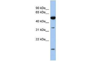 WB Suggested Anti-RDH12 Antibody Titration: 0. (RDH12 抗体  (Middle Region))