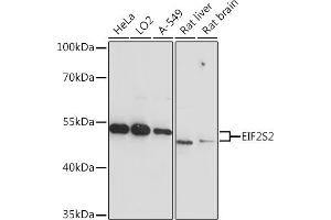 Western blot analysis of extracts of various cell lines, using EIF2S2 Rabbit pAb  at 1:3000 dilution. (EIF2S2 抗体  (AA 1-175))