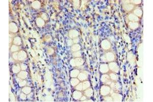 Immunohistochemistry of paraffin-embedded human colon tissue using ABIN7154112 at dilution of 1:100 (GSTM4 抗体  (AA 1-218))