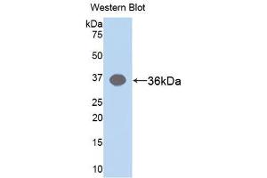 Western blot analysis of the recombinant protein. (ARG 抗体)