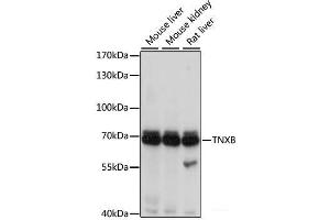 Western blot analysis of extracts of various cell lines using TNXB Polyclonal Antibody at dilution of 1:1000. (TNXB 抗体)
