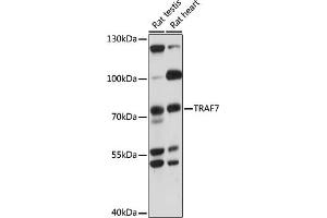 Western blot analysis of extracts of various cell lines, using TR antibody (ABIN7270839) at 1000 dilution. (TRAF7 抗体  (AA 260-400))
