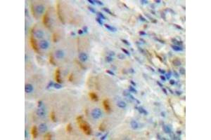 IHC-P analysis of Liver tissue, with DAB staining. (CD79a 抗体  (AA 30-193))