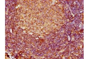 Immunohistochemistry (IHC) image for anti-Fc Fragment of IgE, Low Affinity II, Receptor For (CD23) (FCER2) (AA 48-321) antibody (ABIN7158533)