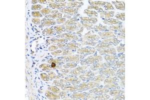Immunohistochemistry of paraffin-embedded mouse stomach using IL6 antibody at dilution of 1:100 (40x lens). (IL-6 抗体)