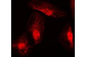 Immunofluorescent analysis of RANBP6 staining in K562 cells. (RANBP6 抗体  (Center))
