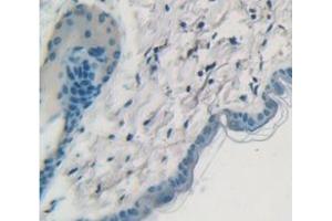 Figure. (Cytokeratin 1 抗体  (AA 189-497))