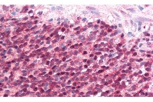 Detection of ICOSLG in Human MALT of Colon Tissue using Polyclonal Antibody to Inducible T-Cell Co Stimulator Ligand (ICOSLG)