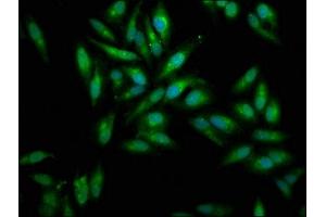 Immunofluorescence staining of Hela cells with ABIN7159428 at 1:100, counter-stained with DAPI. (Mesothelin 抗体  (AA 37-598))