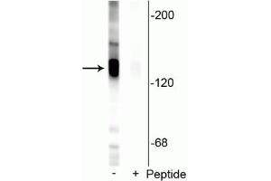 Western blot of rat hippocampal lysate showing specific labeling of the ~135 kDa KCC2 protein phosphorylated at Ser940 in the first lane (-).