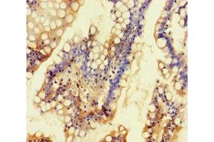 Immunohistochemistry of paraffin-embedded human small intestine tissue using ABIN7163928 at dilution of 1:100 (KCNK16 抗体  (AA 259-309))