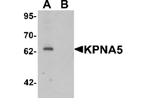 Western blot analysis of KPNA6 in EL4 cell lysate with KPNA5 antibody at 1 µg/mL in (A) the absence and (B) the presence of blocking peptide. (KPNA5 抗体  (N-Term))