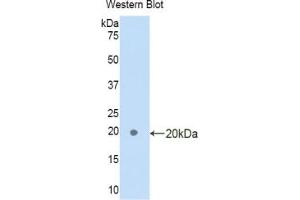 Western blot analysis of the recombinant protein. (FAM132A 抗体  (AA 92-241))