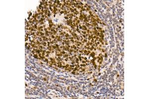 Immunohistochemistry of paraffin-embedded human tonsil using [KO Validated] DNMT1 Rabbit mAb (ABIN7266808) at dilution of 1:100 (40x lens). (DNMT1 抗体)