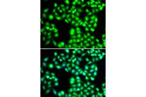 Immunofluorescence analysis of A-549 cells using YTHDC1 antibody. (YTHDC1 抗体  (AA 260-500))