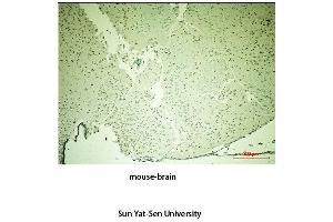 Immunohistochemistry (IHC) analysis:Please contact us for more details. (TH 抗体  (Tyr161))