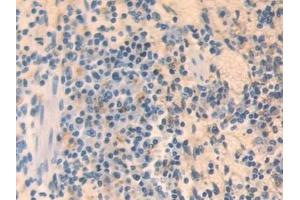 Detection of MX1 in Mouse Spleen Tissue using Polyclonal Antibody to Myxovirus Resistance 1 (MX1) (MX1 抗体  (AA 43-308))