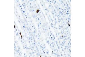 Immunohistochemistry (IHC) image for anti-Somatostatin (SST) (AA 23-116) antibody (ABIN7270492)