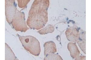 Immunohistochemistry (IHC) image for anti-Protein tyrosine Phosphatase, Receptor Type, B (PTPRB) (AA 1041-1310) antibody (ABIN7443743)