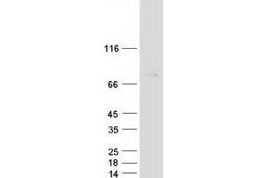 Validation with Western Blot