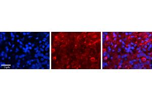 Immunohistochemistry (IHC) image for anti-Solute Carrier Family 27 (Fatty Acid Transporter), Member 6 (SLC27A6) (Middle Region) antibody (ABIN2781556)