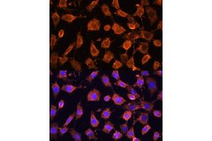 Immunofluorescence analysis of L929 cells using RPL11 antibody (ABIN6129101, ABIN6147106, ABIN6147108 and ABIN6222040) at dilution of 1:100. (RPL11 抗体  (AA 1-177))