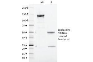 SDS-PAGE Analysis of Purified, BSA-Free CD71 Antibody (clone TFRC/1817).