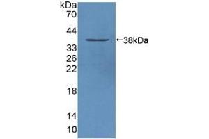 Detection of Recombinant STAM1, Mouse using Polyclonal Antibody to Signal Transducing Adaptor Molecule 1 (STAM1) (STAM 抗体  (AA 199-464))