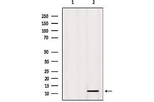 Western blot analysis of extracts from Mouse spleen, using CSTA Antibody. (CSTA 抗体  (C-Term))