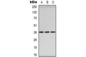 Western blot analysis of CER1 expression in MCF7 (A), rat heart (B), rat brain (C) whole cell lysates. (CER1 抗体)
