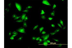 Immunofluorescence of monoclonal antibody to FTCD on HepG2 cell. (FTCD 抗体  (AA 440-541))
