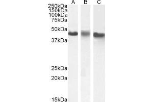 ABIN238540 (1 μg/mL) staining of A431(A), HeLa (B) and K562 (C) nuclear cell lysate (35 μg protein in RIPA buffer). (CK1 epsilon 抗体  (C-Term))